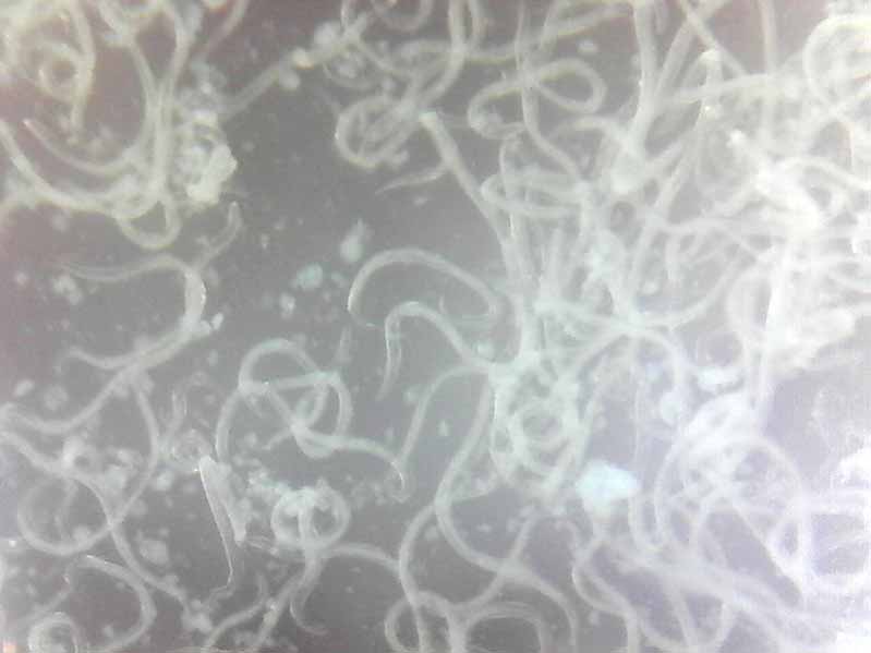 Microscopic view of Steinernema nematodes.