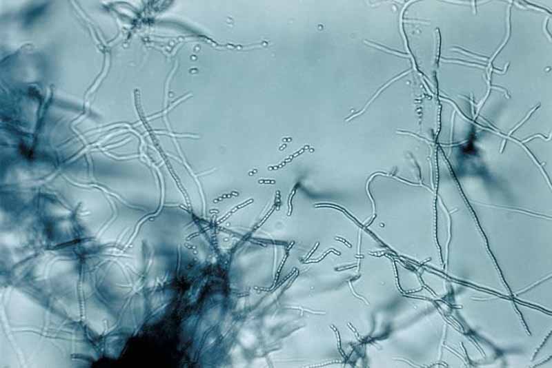 A microscopic vie of the Streptomyces bacteria.