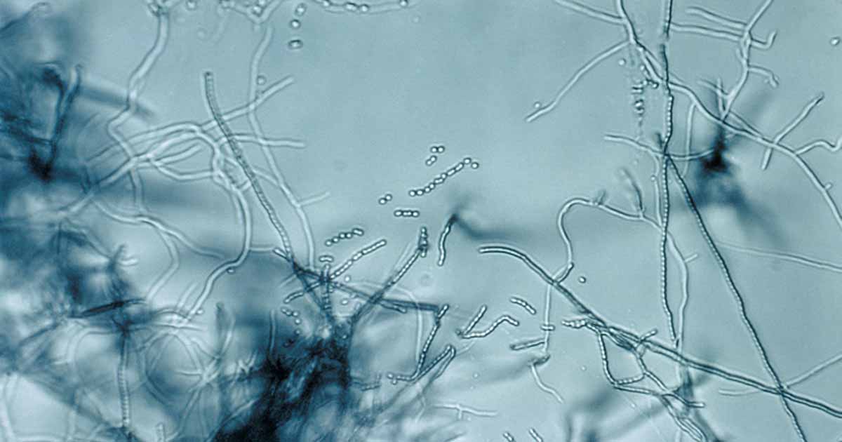 How to Use Streptomyces Lydicus to Battle Fungi and Plant Pathogens