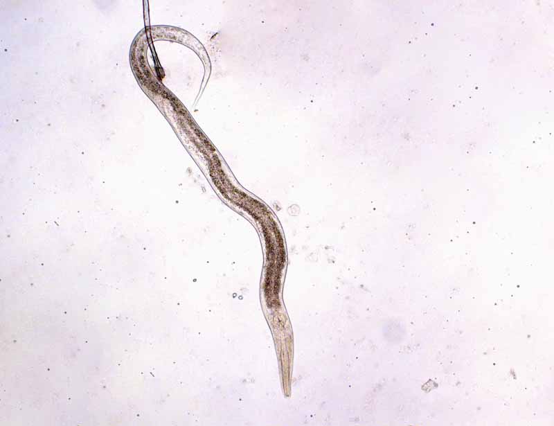 A close up horizontal image of a nematode as viewed under a microscope. 